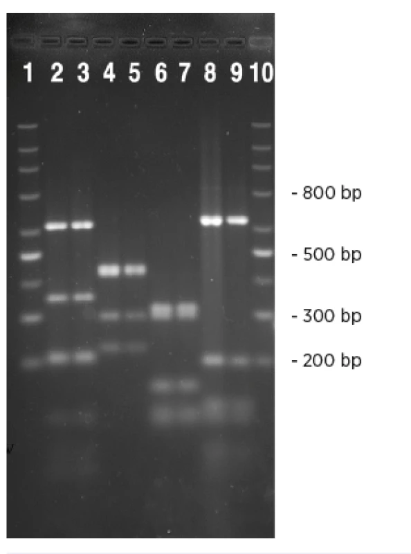 Srovnání HhaI &lt;i&gt;fli&lt;/i&gt;C-RFLP profilů nepohyblivých (NM) kmenů EHEC séroskupin identifikovaných v této studii s kontrolními kmeny odpovídajícího H antigenu. V drahách 2–9 jsou &lt;i&gt;fli&lt;/i&gt;C-RFLP profily těchto kmenů: 2, O157:NM [&lt;i&gt;fli&lt;/i&gt;CH7]; 3, U 5/41 (E. coli O1:K1:H7); 4, O26:NM [&lt;i&gt;fli&lt;/i&gt;CH11]; 5, Su 4321/41 (E. coli O13:11L:H11); 6, O111:NM [&lt;i&gt;fli&lt;/i&gt;CH8]; 7, Ap. 320c (E. coli O2:-:H8); 8, O118:NM [&lt;i&gt;fli&lt;/i&gt;CH25]; 9, N 234 (E. coli O13:-:H25). Dráhy 1 a 10 obsahují marker (DNA marker 200-1500; Top-Bio, Česká republika).
Fig. 1. The comparison of the HhaI fliC-RFLP profiles of the non-motile (NM) strains of EHEC of serogroups identified in this study with those of H antigen-matched controls Lanes 2–9: fliC-RFLP profiles of the following strains: 2, O157:NM [fliCH7]; 3, U 5/41 (&lt;i&gt;E. coli&lt;/i&gt; O1:K1:H7); 4, O26:NM [fliCH11]; 5, Su 4321/41 (&lt;i&gt;E. coli&lt;/i&gt; O13:11L:H11); 6, O111:NM [fliCH8]; 7, Ap. 320c (&lt;i&gt;E. coli&lt;/i&gt;O2:-:H8); 8, O118:NM [fliCH25]; 9, N 234 (&lt;i&gt;E. coli&lt;/i&gt; O13:-:H25). Lanes 1 and 10 show a marker (DNA marker 200-1500; Top-Bio, Czech Republic).
