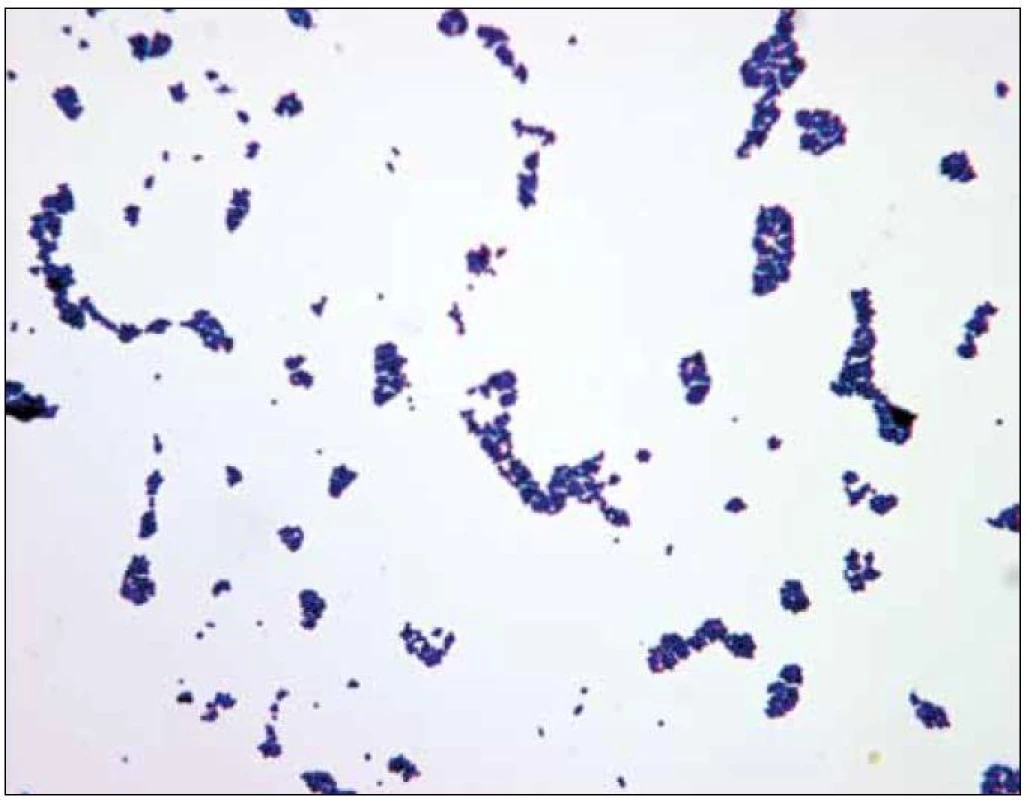 Mikroskopický nález &lt;em&gt;Staphylococcus aureus&lt;/em&gt;.