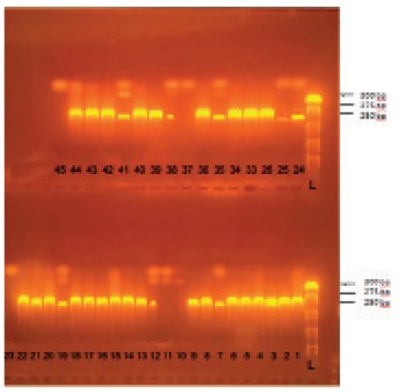 Príklad gélovej elektroforézy amplifikovaného PCR produktu – špecifického úseku nuc génu S. aureus