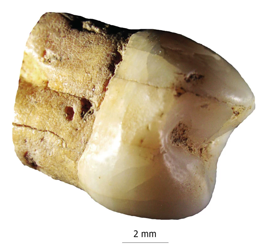 Zub ze Souboru 1. Dobře zachovalý bez patologických a postdepozičních alterací. Stereoscopic Zoom Microscope SMZ1500 (Nikon).