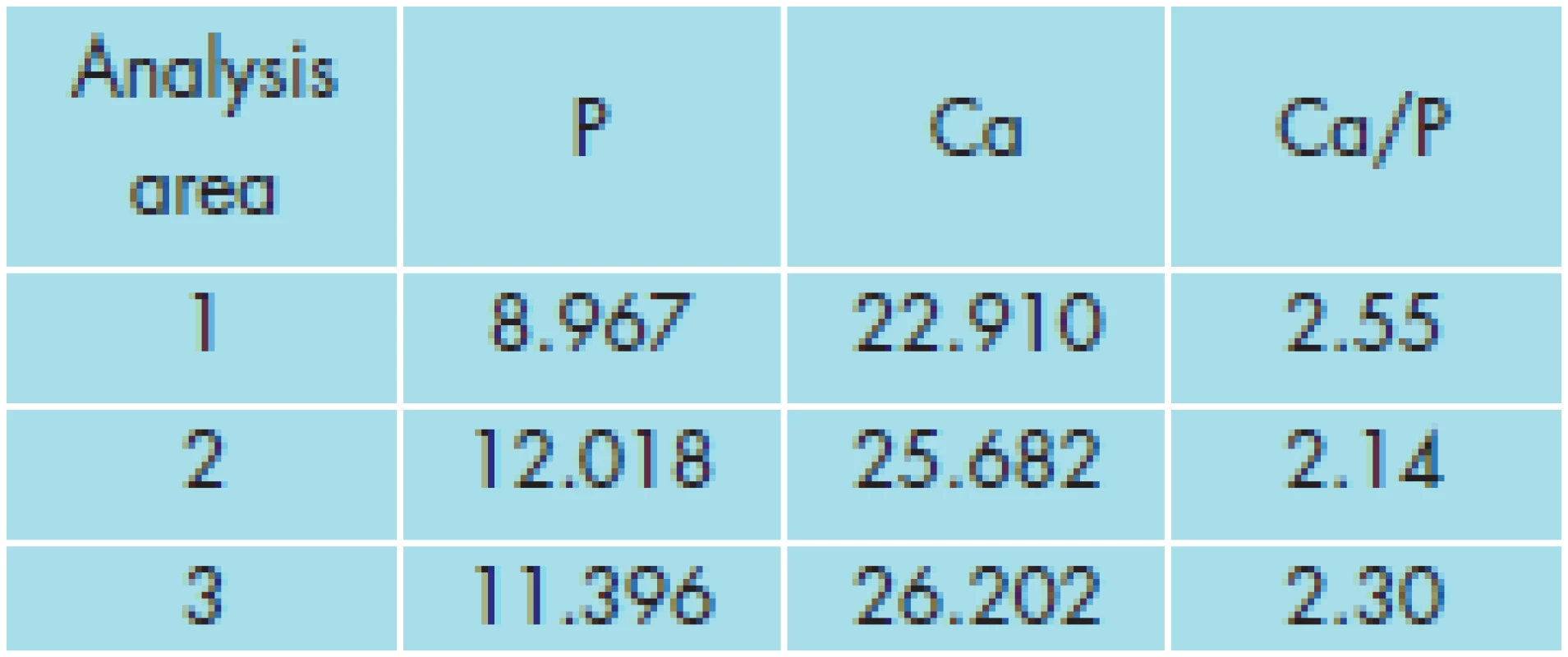 The concentrations of Ca and P in three areas of the investigated calcifications according to EDX analysis (wt.%).