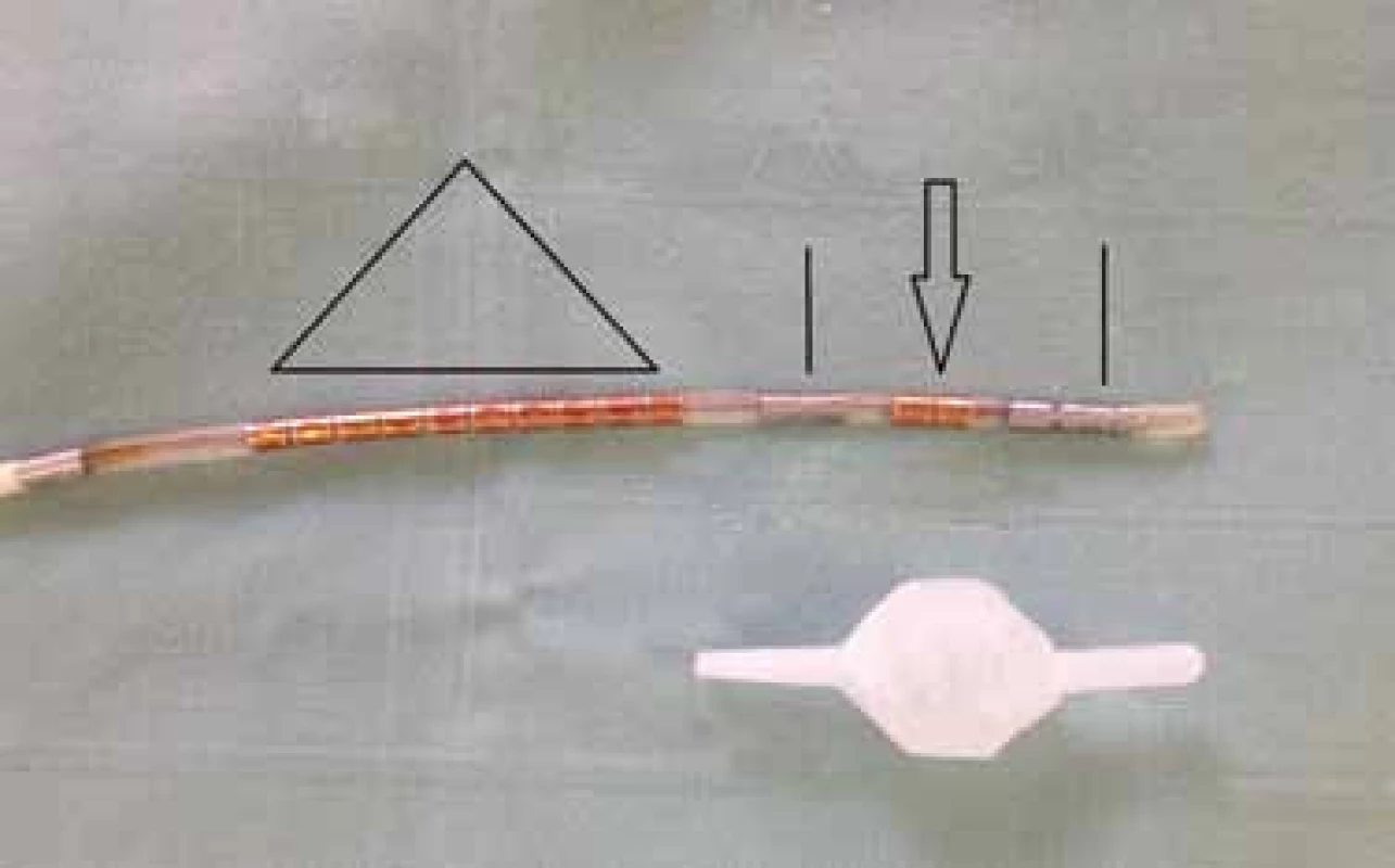 HRAM katetr s rektálním balonkem.
Fig. 3. HRAM catheter with rectal balloon.