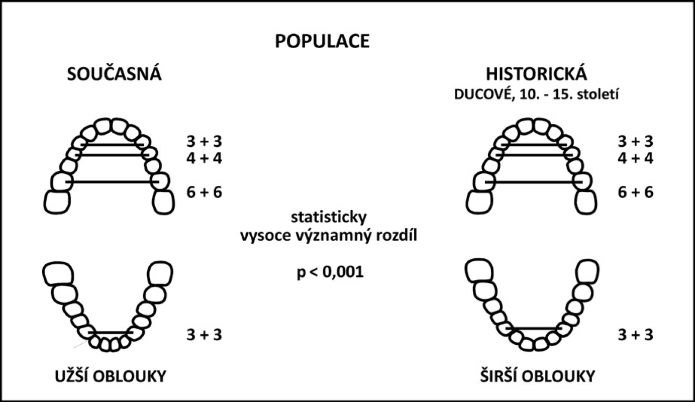 Porovnání transverzálních rozměrů zubních oblouků historické a recentní populace