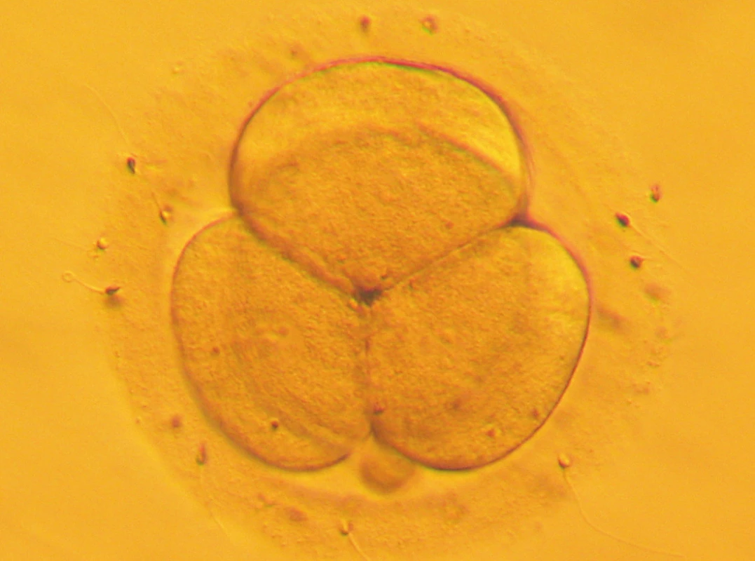 Pravidelně se dělící embryo se 4 buňkami