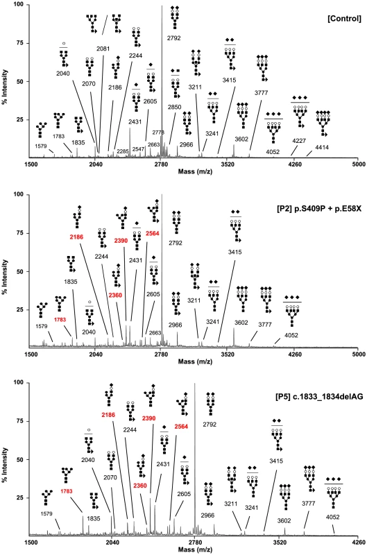 MAN1B1-deficient individuals are deficient in protein N-glycosylation.