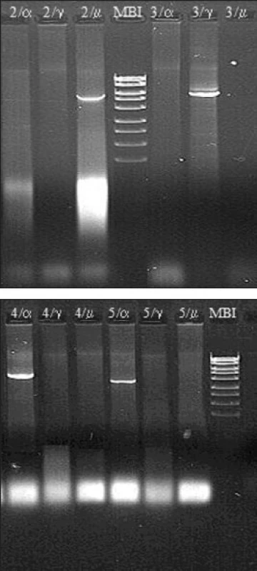 a. a b. Molekulárně biologická diagnostika Burkittova lymfomu – metoda long distance PCR (materiál Centra molekulární biologie a genové terapie Interní hematoonkologické kliniky, zpracovala A. Marečková). 
Metoda umožňuje detekovat nejčastější translokaci u Burkittova lymfomu t(8;14)(q24;q32). Diagnostika je založena na třech nezávislých PCR reakcích s jedním společným primerem navrženým do 2. exonu genu c-myc a třemi primery navrženými do konstantních oblastí Cα, Cμ a Cγ genu pro IgH.