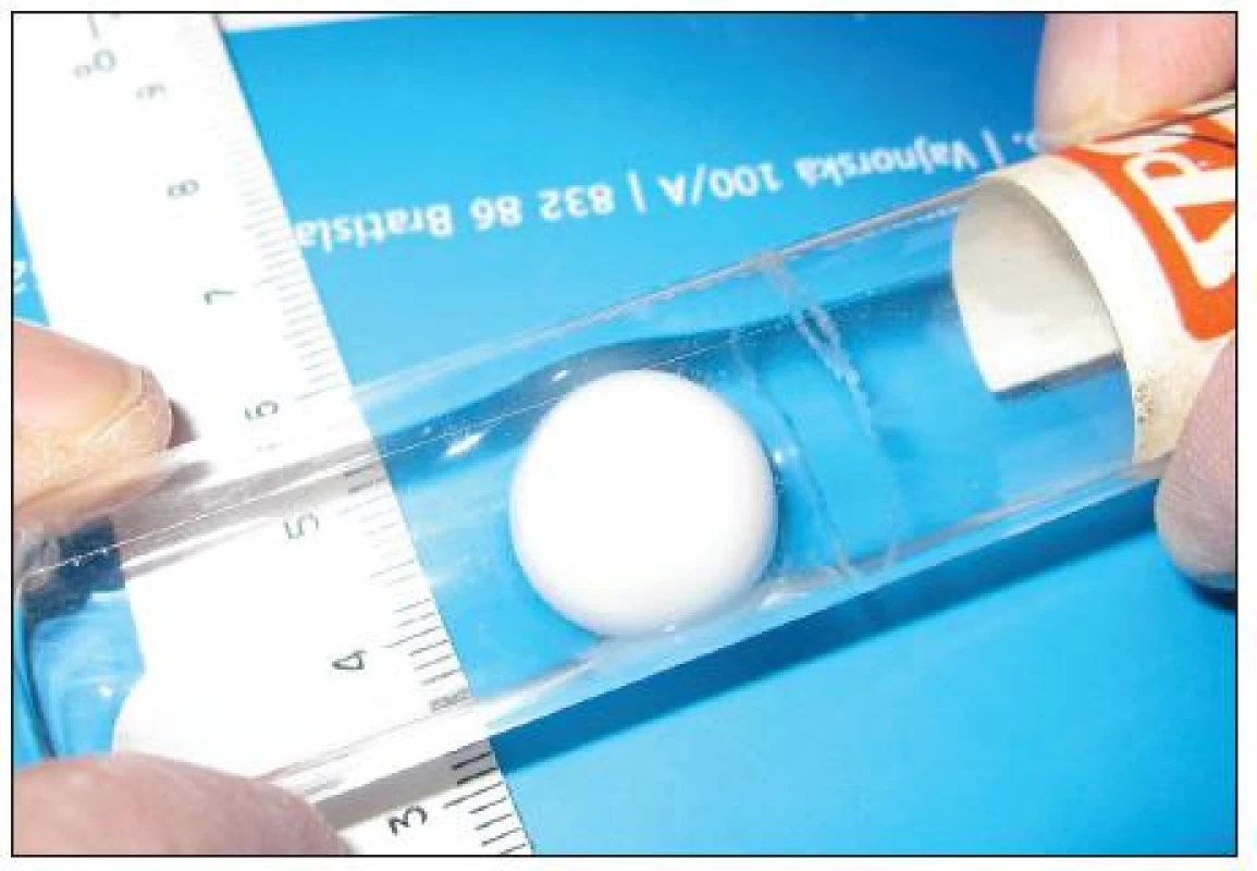 Implantát z hydrogélu methylmetakrylátu „HYDRON SPOFA“ – originálne bol dodávaný sterilne, v zatavenej ampulke. Pre porovnanie je priložená mm stupnica
