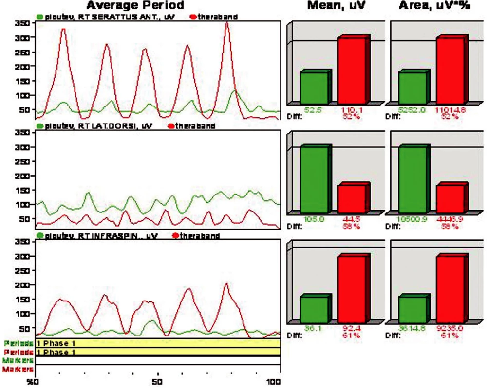 Porovnání rektifikovaného EMG v obou případech experimentu (zelená křivka - vodní prostřední, červená křivka - mimo vodní prostředí).