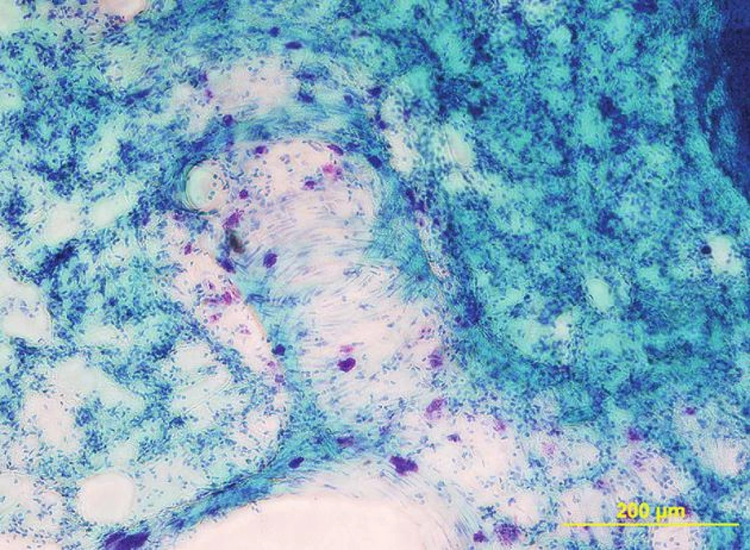 Žírné buňky v plicní tkáni laboratorního potkana. Purpurově zbarvené buňky se nacházejí především v okolí větvení bronchů a cév (na tlustém řezu 200 μm, barveno toluidinovou modří)