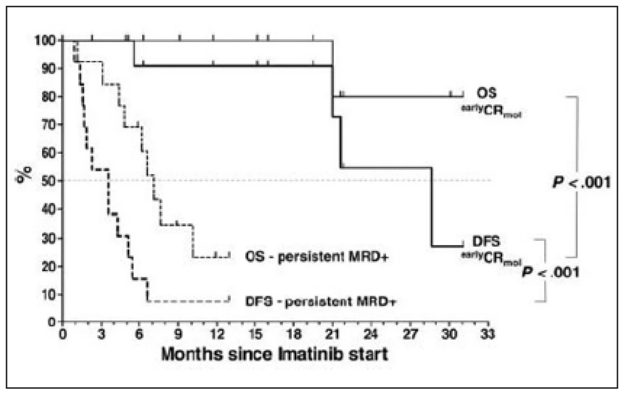 Celkové přežití (OS) a přežití bez příznaku nemoci (DFS) u alogenně transplantovaných pacientů s Ph+ ALL, u nichž došlo po transplantaci k molekulárnímu relapsu nemoci, který byl léčen imatinibem. Převzato z Wassmannová a kol., 2005 (41).