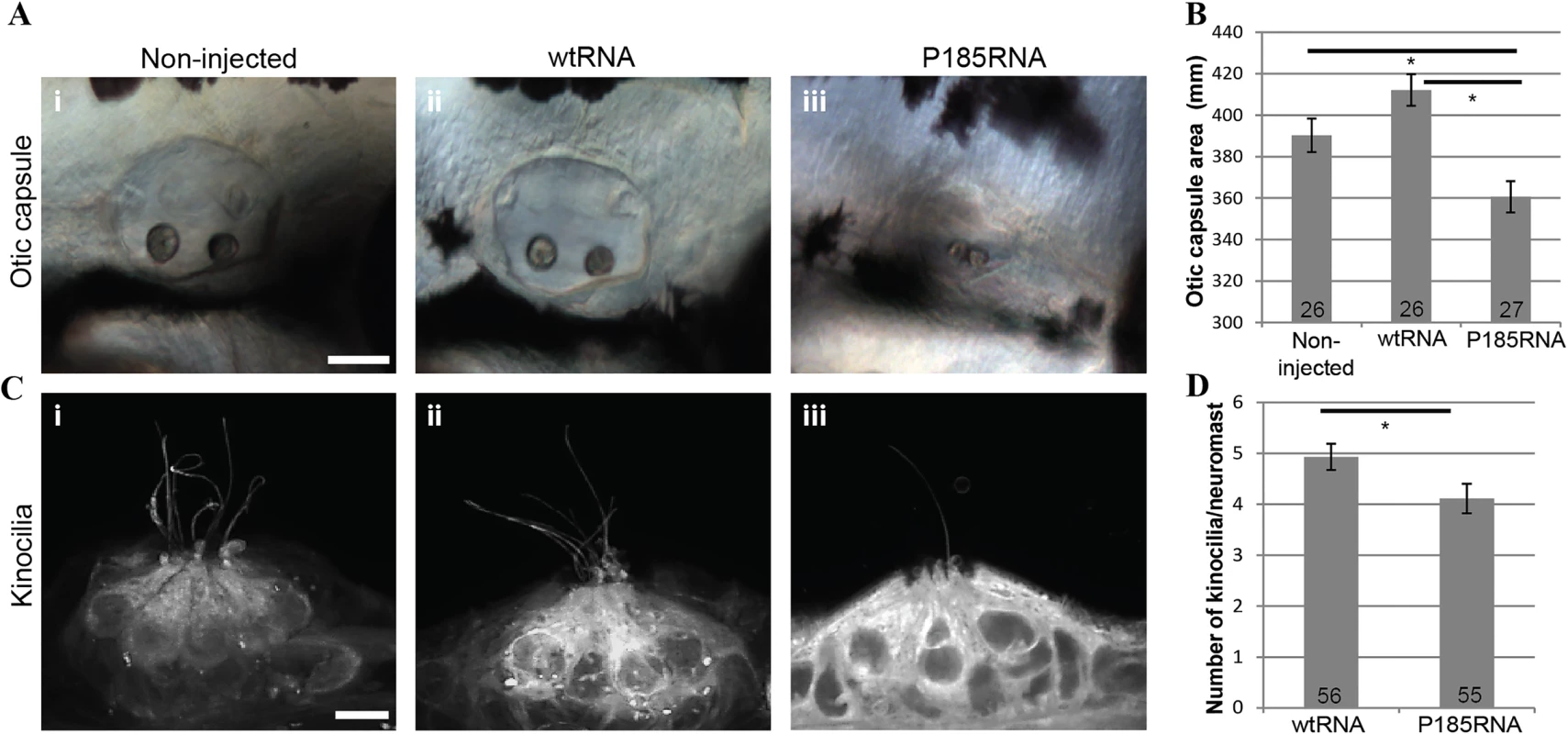 Over-expression of wtRNA and P185RNA in zebrafish embryos.