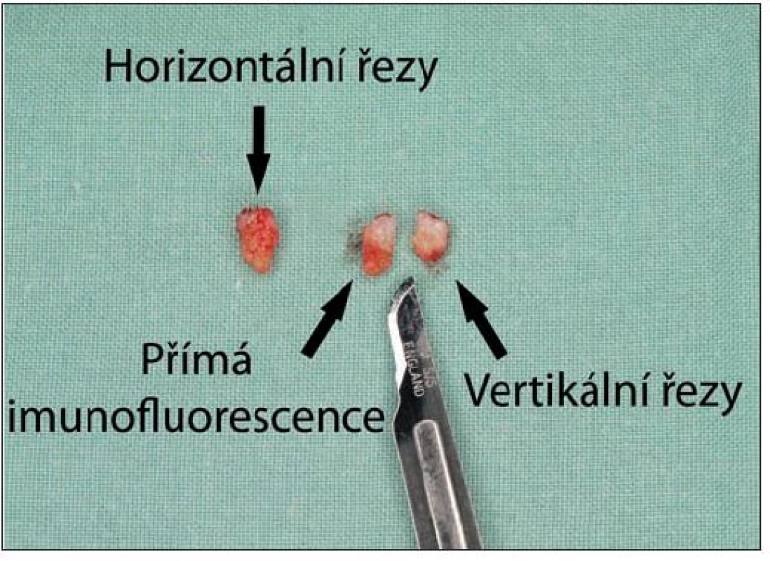 Vzorky na horizontální a vertikální řezy a přímou imunofluorescenci