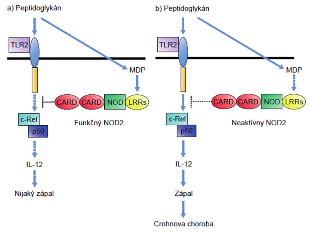 Vplyv mutácie NOD-2 na signalizáciu cez receptor TLR-2 
Peptidoglykánmi indukovaná signalizácia cez TLR2 vedie aktiváciou transkripčného faktora NF-κB (cRel – p50) k produkcii IL-12 a tým k polarizácii imunitnej odpovede do T&lt;sub&gt;H&lt;/sub&gt;1-smeru. Signalizácia cez NOD-2, ktorý rozpoznáva muramyldipeptid, inhibuje signalizáciu cez TLR2 (ľavá časť obrázku). Pri mutácii génu
NOD-2 dochádza k výpadku negatívnej kontroly aktivity TLR2 a tým premrštenej aktivácii T&lt;sub&gt;H&lt;/sub&gt;1-imunitnej odpovede (pravá časť obrázku).
Figure 1. Effect of the NOD-2 mutation on signalling through the TLR-2 receptor
Peptidoglycan induced signalling through TLR2 leads to activation of the transcription factor, NF-κB (cRel – p50), and consequently to the production of IL-12, thus polarizing the immune response toward the T&lt;sub&gt;H&lt;/sub&gt;1 direction. Signalling through NOD-2, which recognizes muramyl dipeptide, inhibits signalling through TLR2
(see the left part of the picture). Mutation of the NOD-2 gene results in the lack of negative control of TLR2 activity and thus in an enhanced activation of the T&lt;sub&gt;H&lt;/sub&gt;1 immune response (see the right part of the picture).