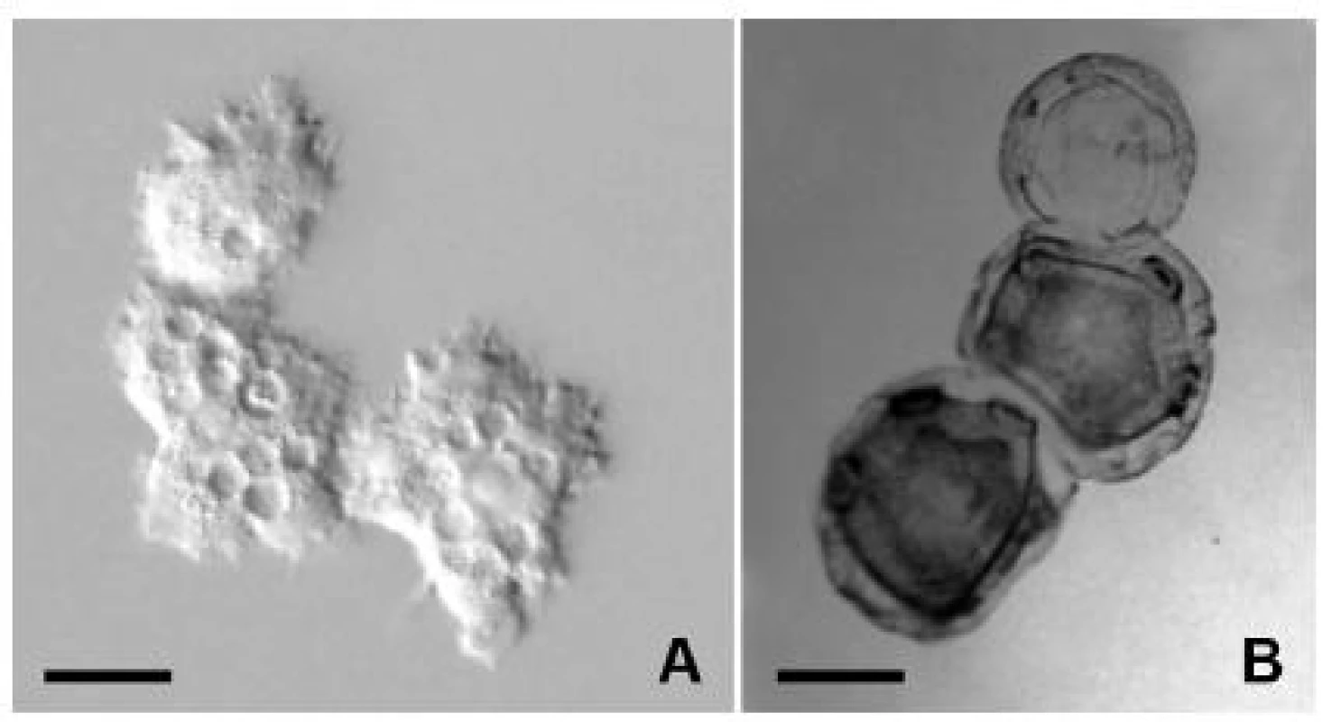Klinický izolát Acanthamoeba lugdunensis z prípadu akantamébovej keratitídy. A – trofozoity in vivo, B – cysty po protargolovej impregnácii. Mierka je 10 μm.
Fig. 1. Clinical isolate of Acanthamoeba lugdunensis from a case of Acanthamoeba keratitis
A – trophozoites in vivo, B – protargol impregnated cysts. Scale bar is 10 μm.