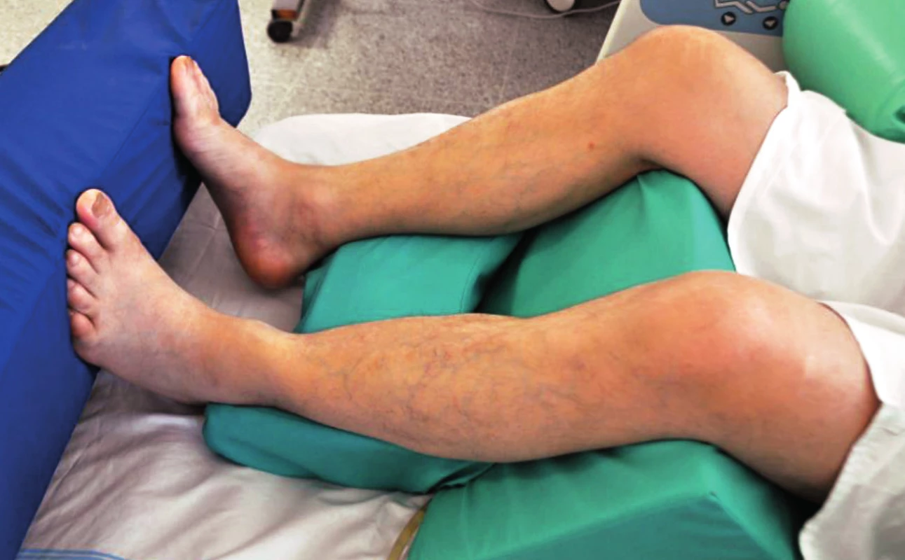 Pozice na zádech – zajištění dolních končetin s flexí v koleni