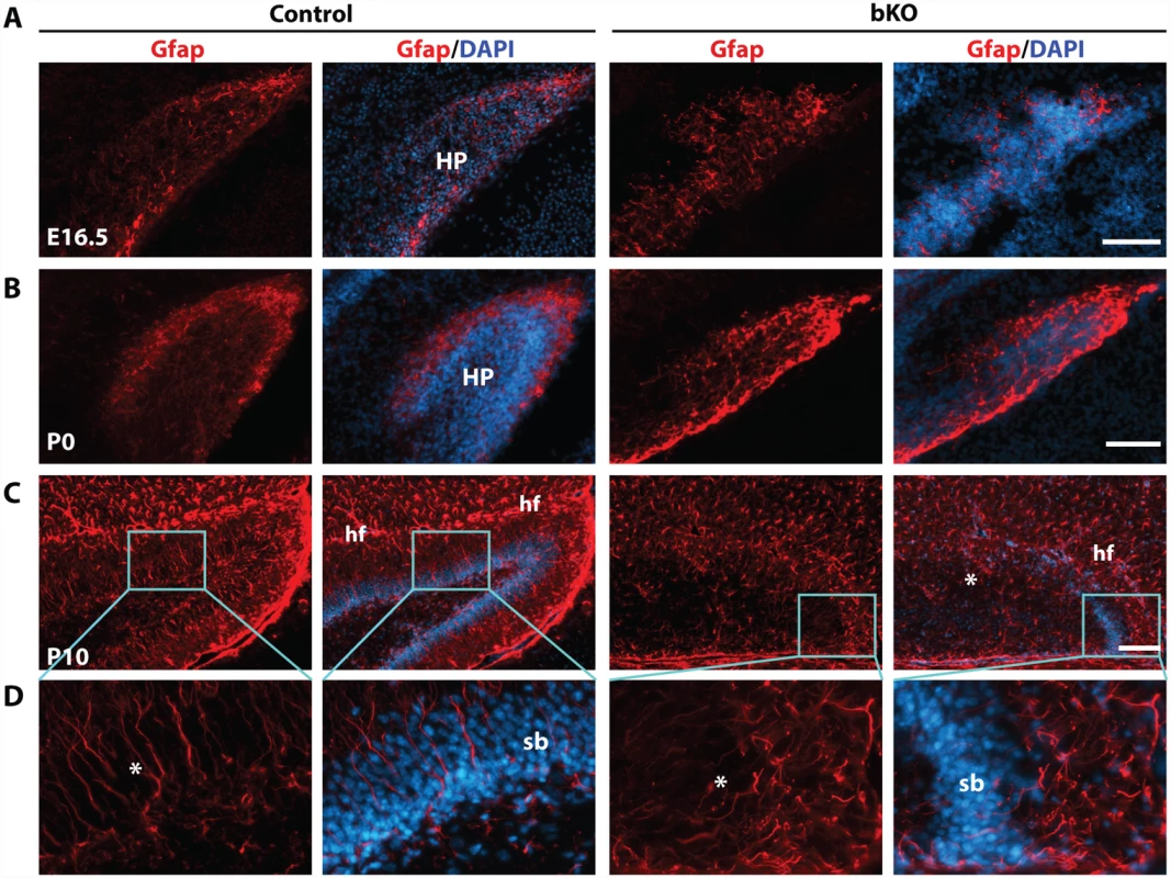 Deregulated Gfap expression in the mutant hippocampus.