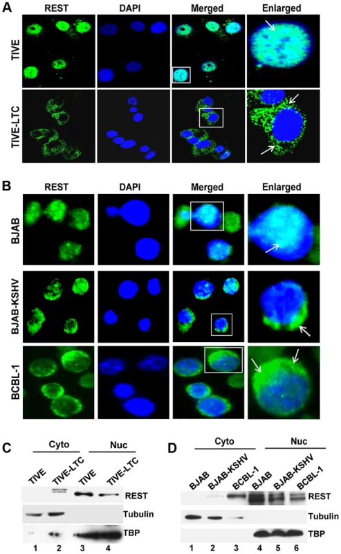 Cytoplasmic localization of REST in KSHV infected cells.