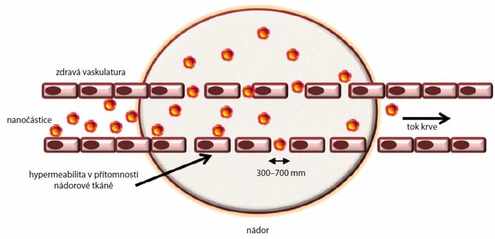 Schématické znázornění kumulace nanočástic v nádorové tkání vlivem EPR efektu, který je důsledkem hyperpermeability cév.