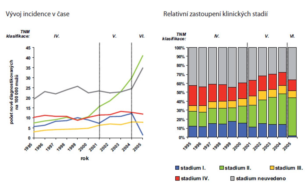 Zastoupení klinických stadií u karcinomu prostaty v české populaci
Fig. 2. Prostate cancer stage distribution in Czech Republic
Delení zhoubného novotvaru prostaty do klinických stadií bylo zavedeno až ve IV. vydání TNM klasifikace zhoubných novotvaru, podle kterého jsou údaje v NOR CR zaznamenávány od roku 1995.