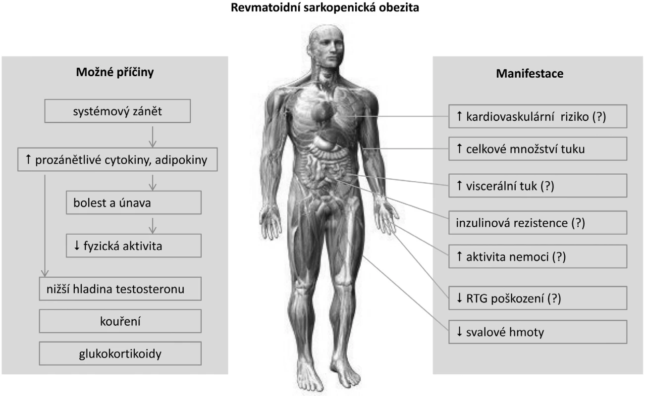 Současné poznatky o mechanismu vzniku a klinických aspektech sarkopenické obezity u revmatoidní artritidy (upraveno podle ref. 4).
