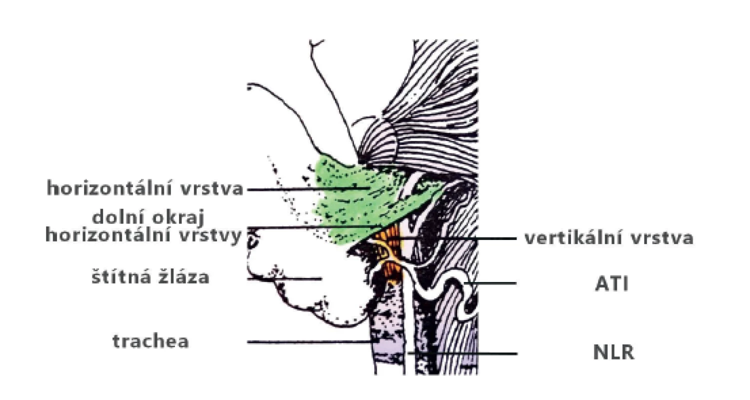 Horizontální a vertikální vrstvy ligamenta Berry<br>
Fig. 6: The horizontal and vertical layers of the ligament
of Berry
