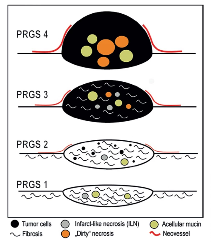 Grafické znázornění PRGS [8]<br>
Fig. 3: Schematic illustration of PRGS [8]