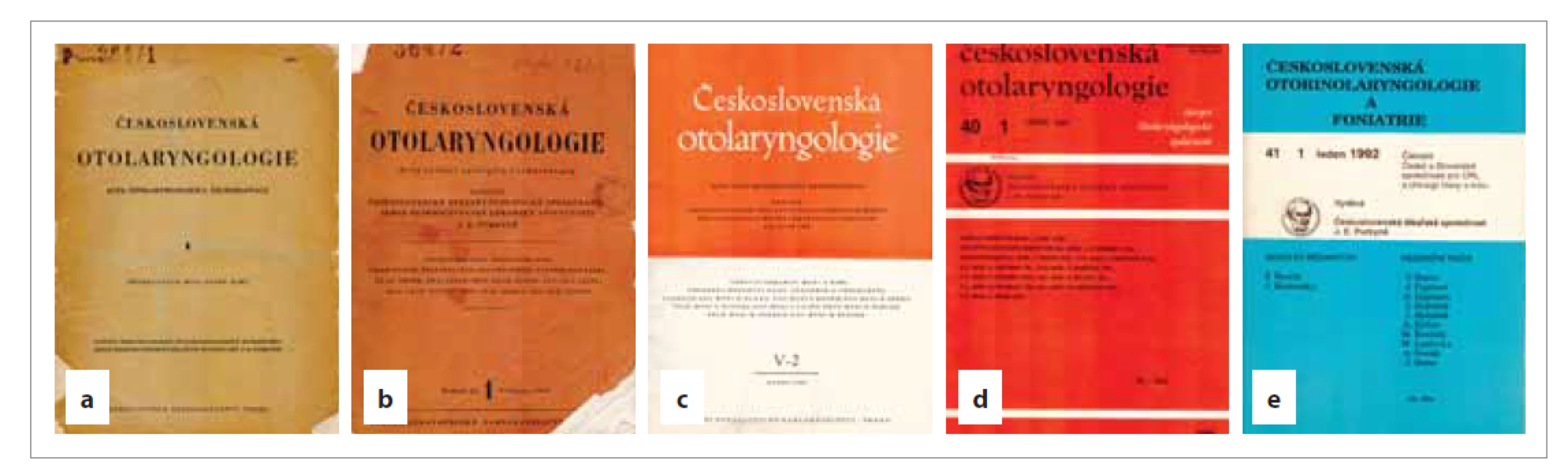 Grafika časopisu od jeho založení v roce 1952 (a), od roku 1956 (b), další formát opouští karmínovou barvu a nahrazuje
ji oranžová barva přechodem k nakladatelství Avicenum od roku 1971 (c, d). Na něj navazuje stále pokračující
formát A5 v roce 1991. Tímto rokem opouští časopis oranžovou barvu a v roce 1992 se objevuje v NTS ČLS JEP barva
modrá (tiskárny používají v té době maximálně dvoubarevný tisk). Text byl tzv. sázený, resp. přepisovaný tiskárnami
a korektory. Rok 1992 je posledním rokem malého formátu. (Tisk uložen v knihovně Kliniky otorinolaryngologie a chirurgie
hlavy a krku 1. LF UK a FN v Motole.)<br>
Fig. 5. Graphics of the magazine since its founding in 1952 (a), since 1956 (b), another format leaves the crimson color and
is replaced by orange by the transition to the publishing house Avicenum from 1971 (c, d). It is followed by the continuing
A5 format in 1991. This year the magazine leaves the orange color and in 1992 the color blue appears in the NTS ČLS JEP
(printers use a maximum of two-color printing at that time). The text was so-called bet, resp. transcribed by printers and
proofreaders. 1992 is the last year of small format. (Print stored in the library of the Department of Otorhinolaryngology and
Head and Neck Surgery, 1st Medical Faculty, Charles University, University Hospital in Motol.)