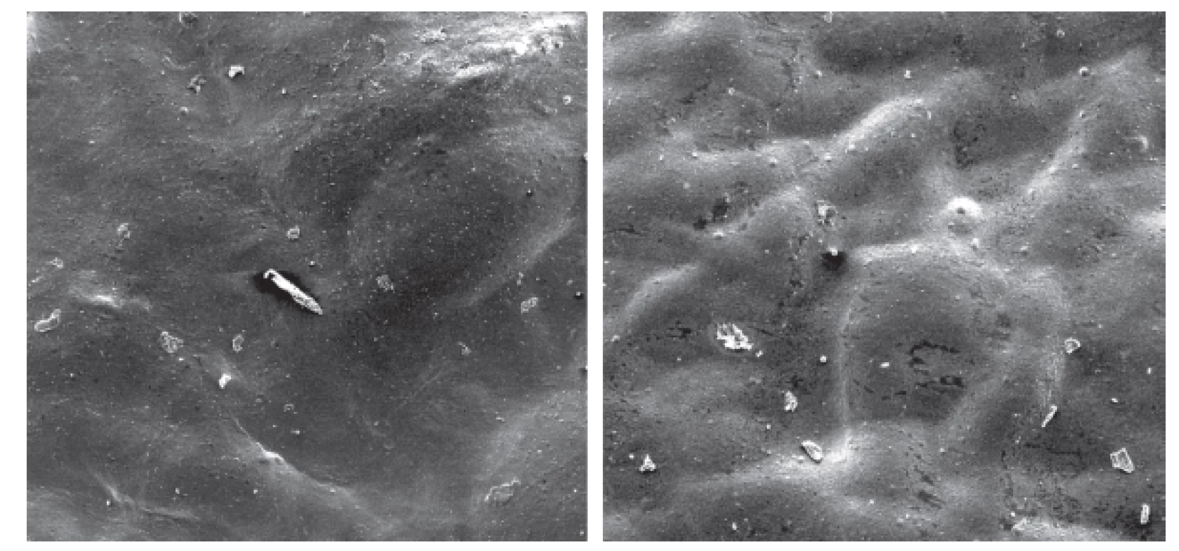 Mikroskopický vzhled filmů při 200násobném přiblížení – film z bovinního kolagenu (vlevo)
a koňského (vpravo) – vrchní vrstvu tvoří kolagen, pod ním jsou patrné obrysy mikrofibrilárních vláken
částečně substituované CMC ve spodní vrstvě