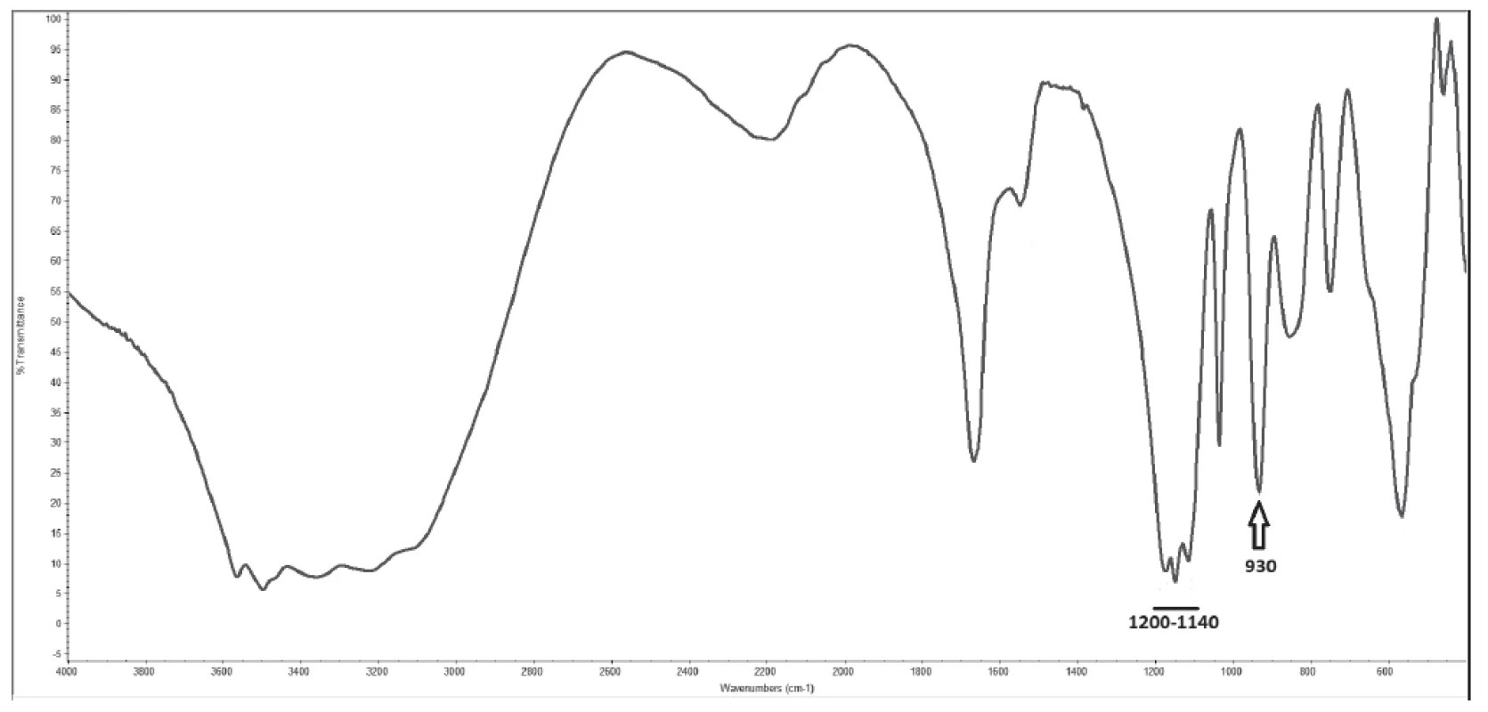 Infra-red spectrometry spectrum of analysed renal
stone with specific peak for pyrophosphate (930 cm-1) and
specific region for sulphates (1200 - 1140 cm-1)