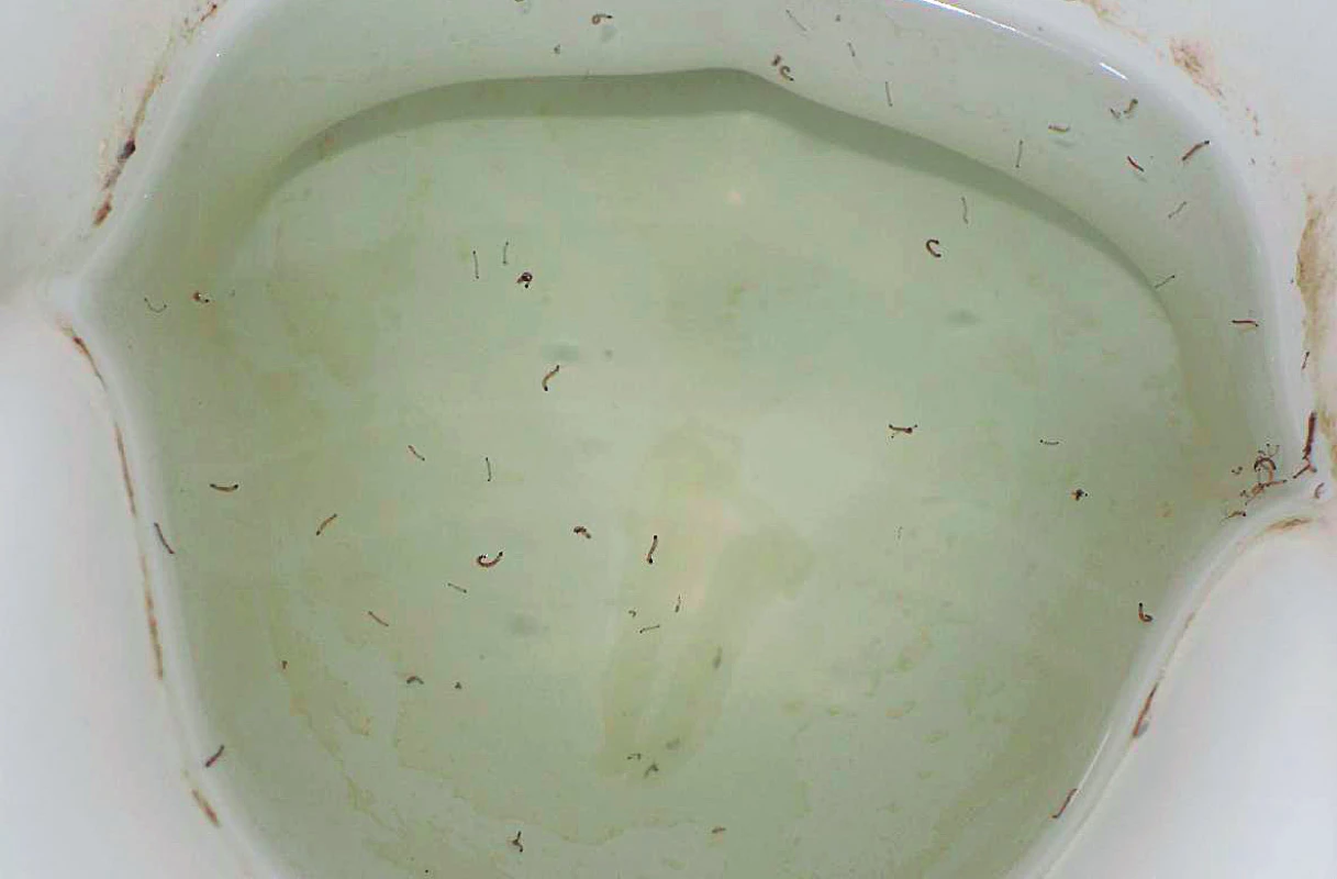 Živé larvy C. albipunctata v záchodové míse (archiv
pacienta)<br>
Figure 3. Live larvae of C. albipunctata in the toilet bowl
(patient’s archive)