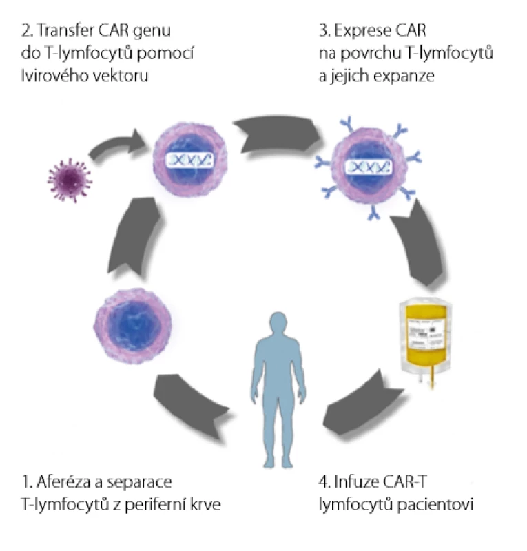 Proces výroby CAR T-lymfocytů