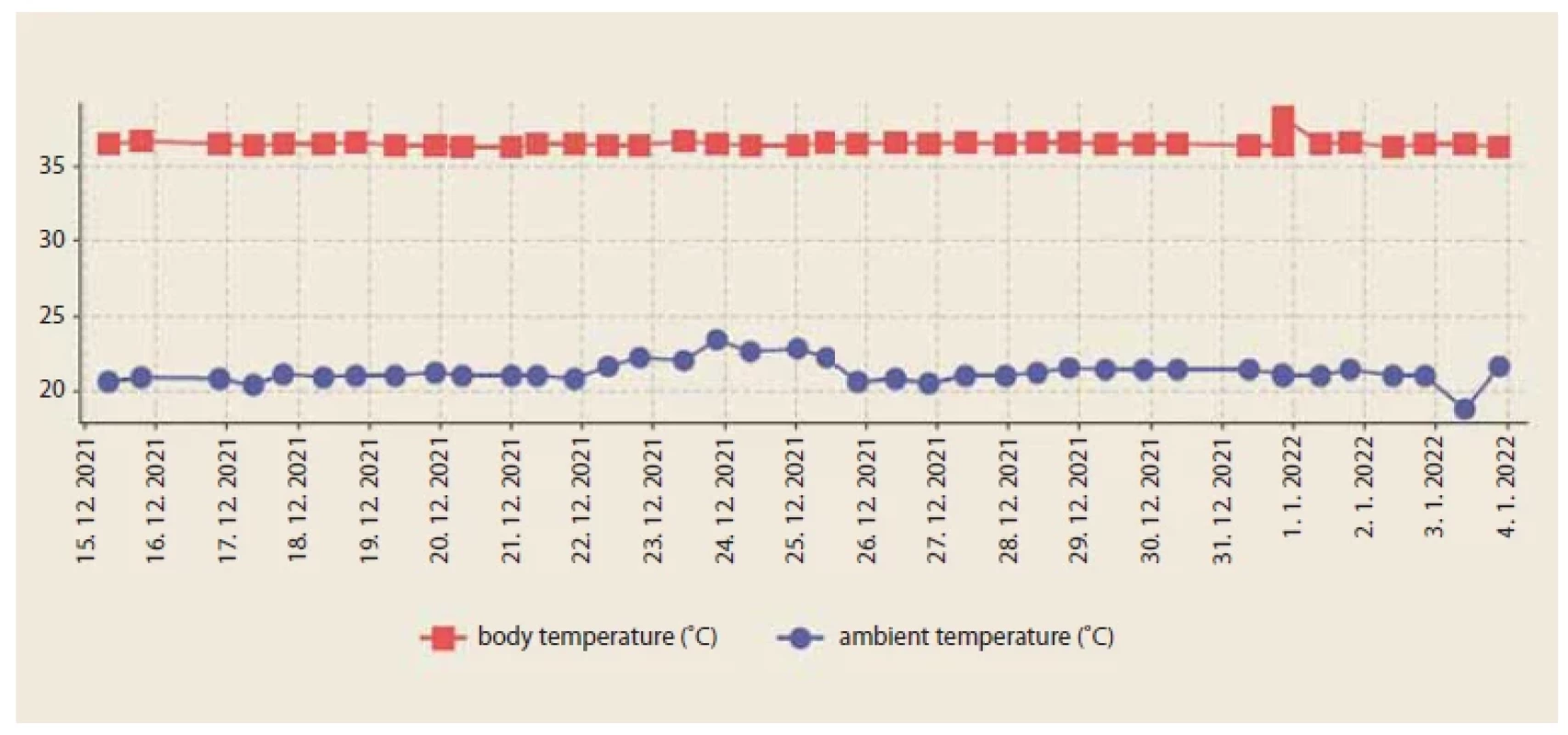 Graph of patient’s temperature aff ecting the decision process in organ allocation [31]. <br> 
Obr. 1. Graf teploty pacienta ovplyvňujúci rozhodovací proces pri prideľovaní orgánov [31].