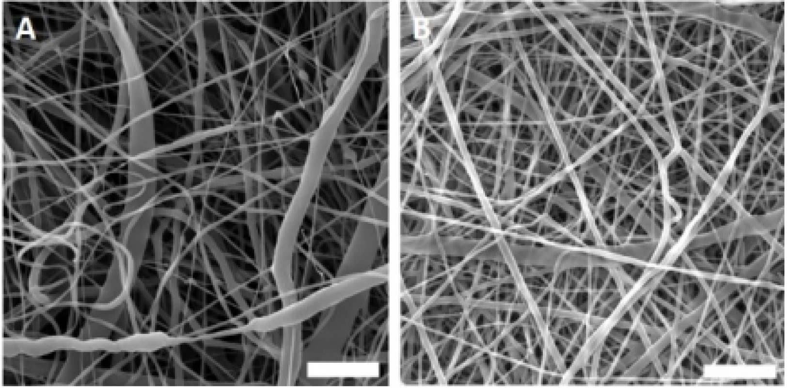 Scanning electron microscopy images of the
fabricated nanofibrous samples. A – PCL, B – PVA.
Magnification 10,000×; scale bar 5 µm.