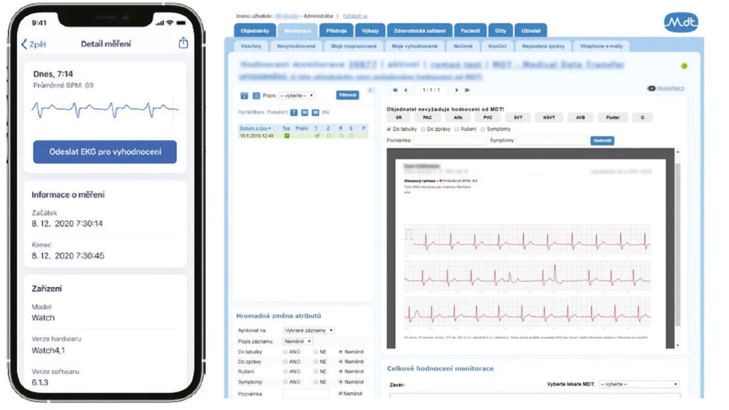 Mobilní aplikace pro zasílání EKG z chytrých hodinek do telemedicínského centra