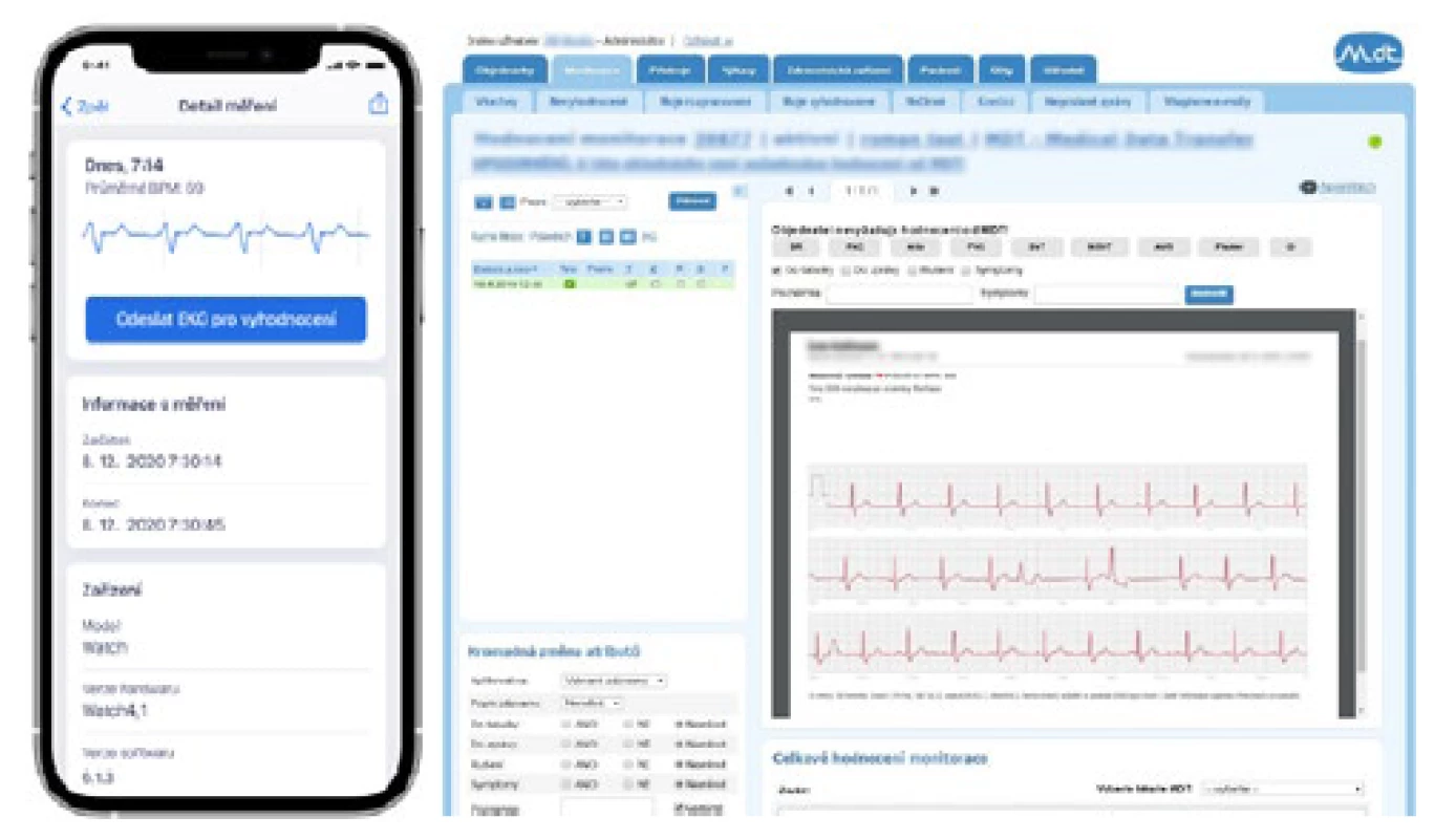 Mobilní aplikace pro zasílání EKG z chytrých hodinek
do telemedicínského centra
