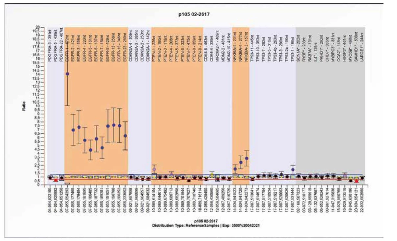 Výsledek molekulárně genetického vyšetření tkáně pomocí SALSA MLPA Probemix P105 Glioma-2. Typický obraz amplifikace genu EGFR s amplifikací
genu NFKBIA.