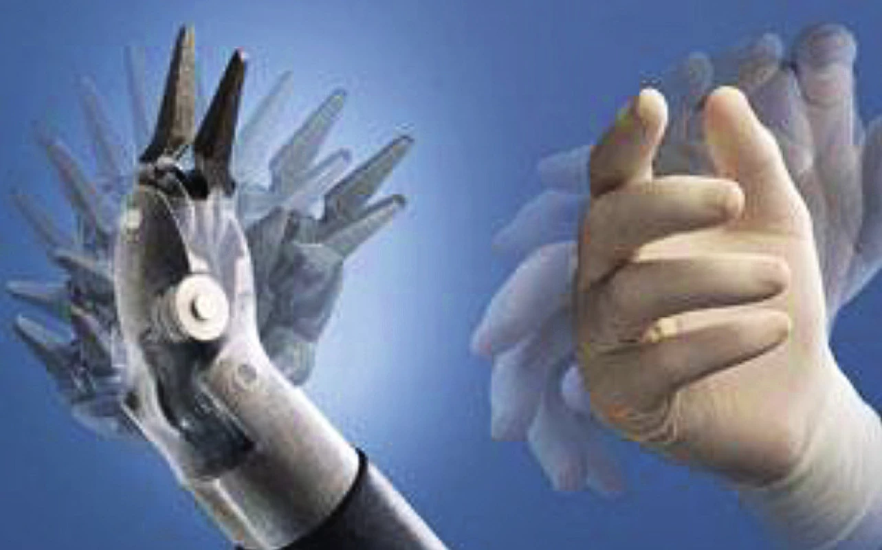 Schéma pohybu s operačními nástroji – je umožněna
maximální pohyblivost, která je stejná jako má lidská ruka.
Zdroj: Intuitive Surgical