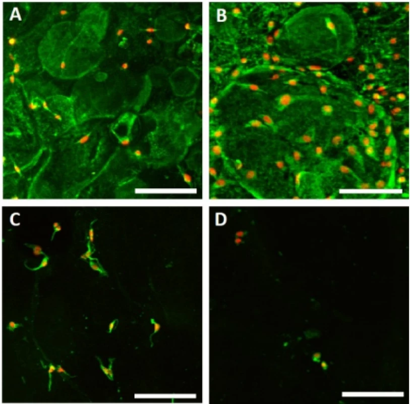 Melanocyte adhesion to the nanofibers. Adhesion of melanocytes was visualized using confocal
microscopy on day 1. Cytoplasm is stained with DiOC6 (green), nuclei with propidium iodide (red). A – PCL,
B – PCL/PL, C – PVA, D – PVA/PL. Objective 20×,
scale bar 100 µm.