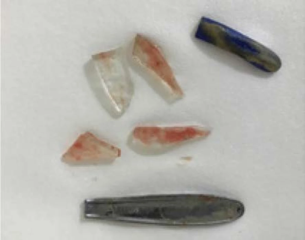 1× plastový válcový úlomek, 4× skleněné
střepiny, 1× přelomená zadní část čajové lžičky<br>
Fig. 1. A plastic cylindrical fragment x1; glass shards
x4; broken back part of a teaspoon x1