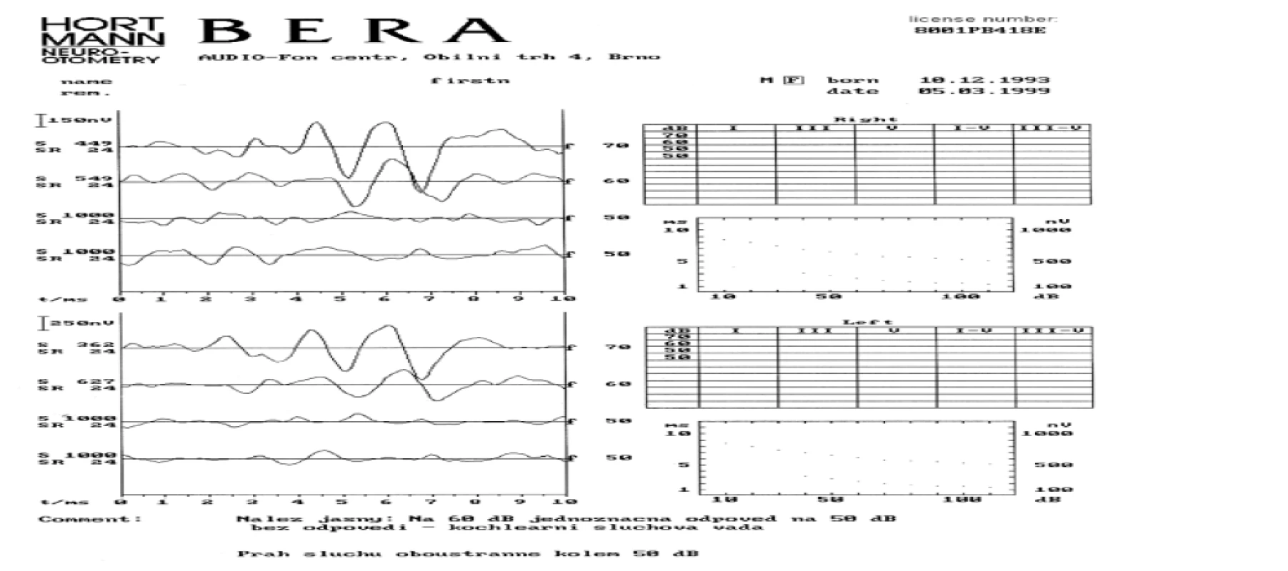 Percepční vada sluchu s prahem na 50/60 dB