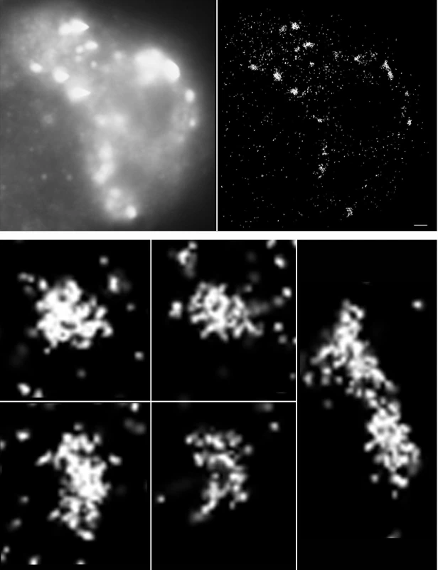 Vizualizace γH2AX v jádře téhož buněčného jádra pomocí standardní imunofluorescenční mikroskopie (A) a lokalizační mikroskopie
s rozlišením jednotlivých molekul (SMLM) (B). 