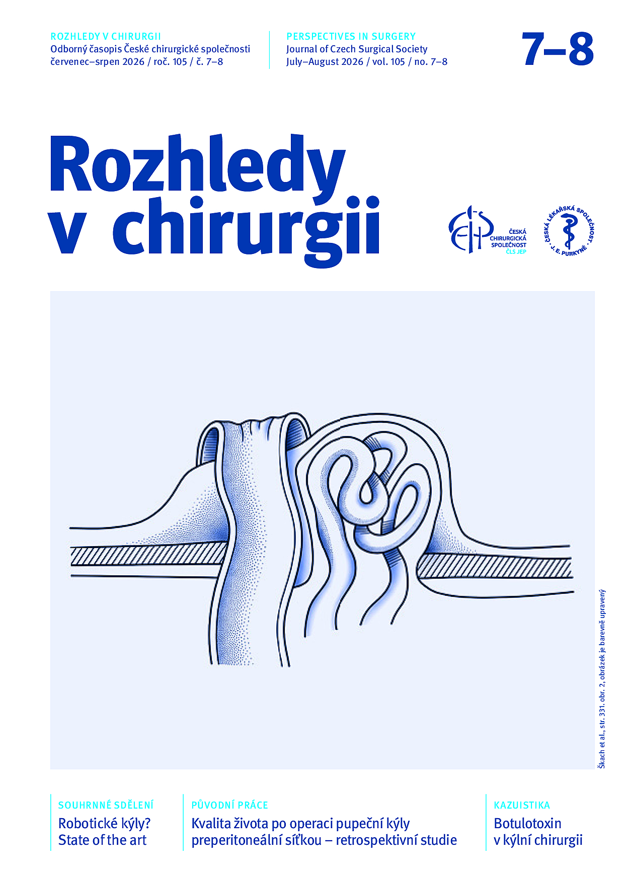 Rozhledy v chirurgii